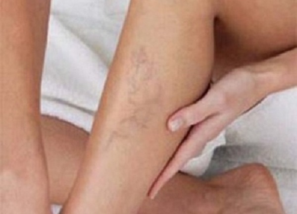 &iquest;Sientes fr&iacute;o en las piernas y las manos? &iexcl;Aprende a controlar la mala circulaci&oacute;n sangu&iacute;nea!