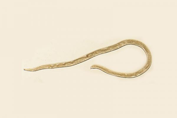 Oregon woman first-ever with human 'eye worm' infection