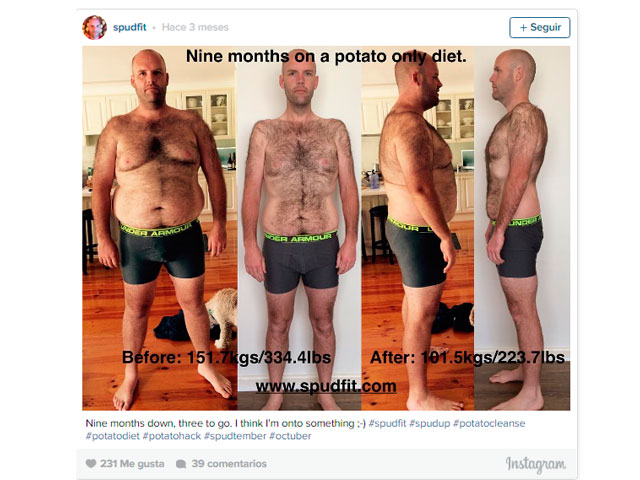 FOTOS IMPACTANTES ANTES Y DESPU&Eacute;S: COMI&Oacute; PAPAS DURANTE UN A&Ntilde;O Y AS&Iacute; EST&Aacute; AHORA SU SALUD