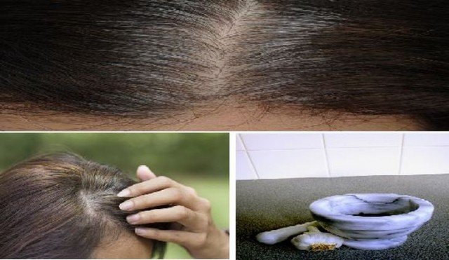 Utiliza esto y en 5 minutos elimina las canas, crece el cabello y evita su ca&iacute;da