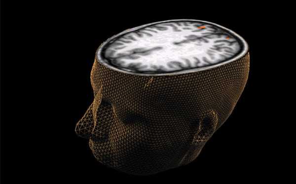 Cient&iacute;ficos descubren c&oacute;mo se crean conexiones entre las neuronas