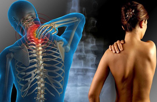 Hierbas para el tratamiento de la fibromialgia