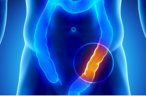 C&oacute;mo limpiar el colon naturalmente
