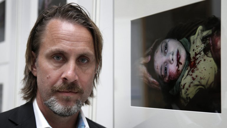 La mirada de una ni&ntilde;a siria herida es "Foto del a&ntilde;o" de Unicef