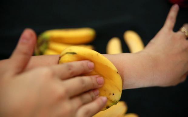 Esto es lo que pasa si pones c&aacute;scara de banana en la piel