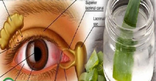 Mejora la presi&oacute;n y la visi&oacute;n intraocular con este remedio casero
