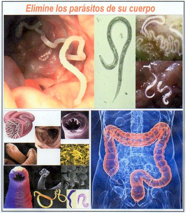  Elimine los dep&oacute;sitos de grasa y los par&aacute;sitos de tu cuerpo 