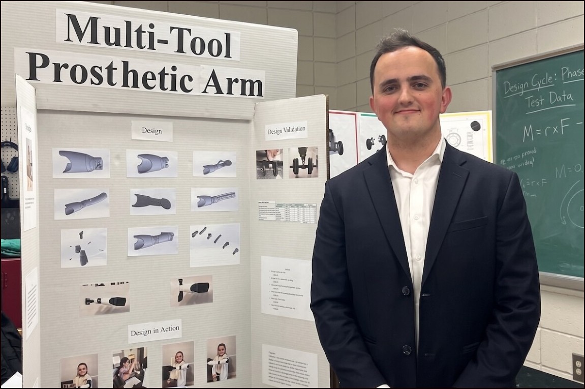 Estudiante pas&oacute; 100 horas frente a impresora 3D para hacerle una pr&oacute;tesis multifunci&oacute;n a su hermana