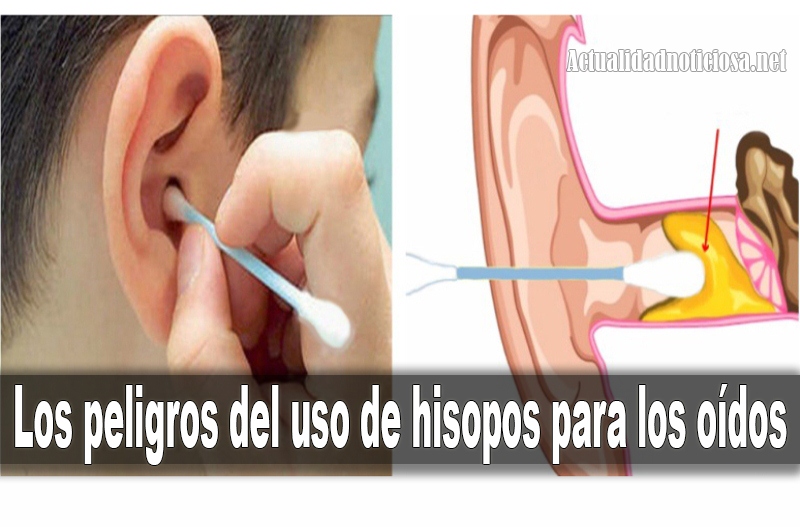 Las propiedades de la cera del o&iacute;do,, no la extraiga con hisopo, le causa problemas