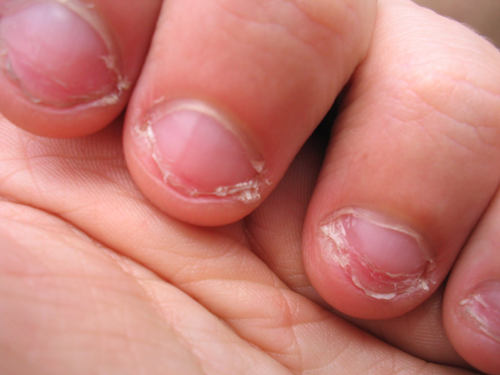 &iquest;POR QU&Eacute; NO DEBER&Iacute;AS MORDERTE LAS U&Ntilde;AS?