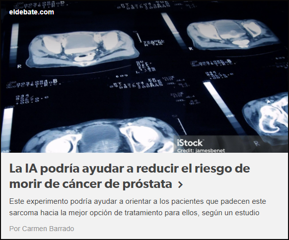  La IA podr&iacute;a ayudar a reducir el riesgo de morir de c&aacute;ncer de pr&oacute;stata