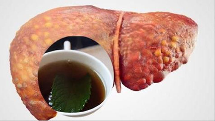 De esta forma puedes limpiar tu h&iacute;gado antes de ir a dormir de manera natural