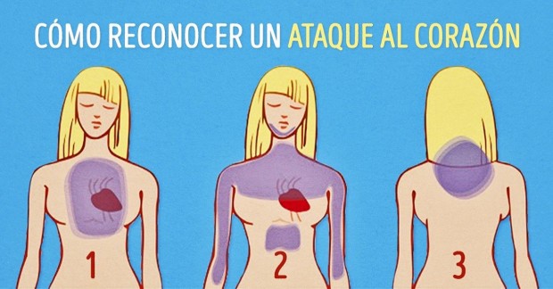  S&iacute;ntomas para sufrir un ataque card&iacute;aco en poco tiempo