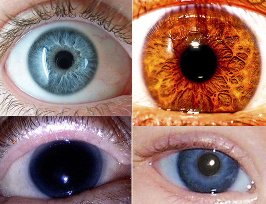 Los colores de ojos m&aacute;s raros en seres humanos
