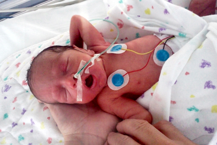 Beb&eacute;s prematuros podr&iacute;an sufrir complicaciones graves