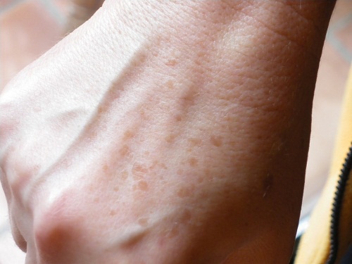 Tonifica la piel y elimina las manchas con estas lociones naturales