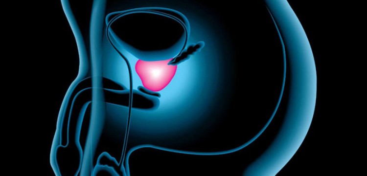  C&aacute;ncer de pr&oacute;stata, 12 s&iacute;ntomas no debes ignorar, puede ser morta