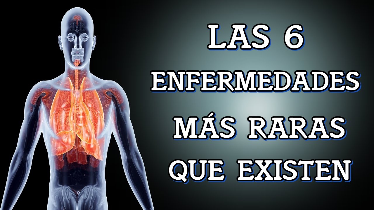 6 Terror&iacute;ficas enfermedades que la ciencia no puede explicar