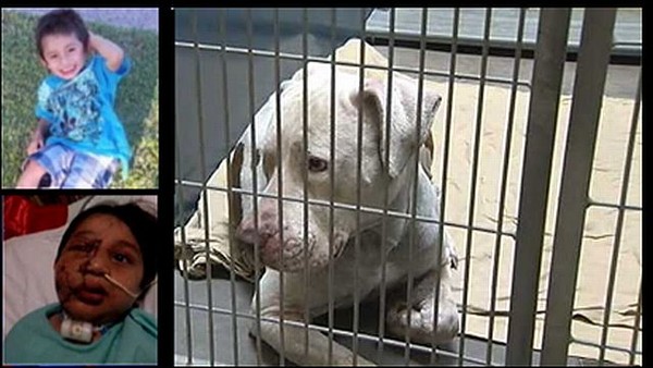 Un pit bull ataca a un ni&ntilde;o y miles de personas piden que el perro no sea sacrificado