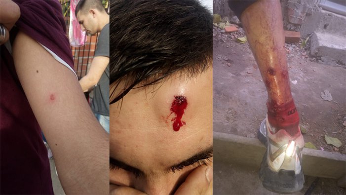 Tigre: polic&iacute;a bonaerense reprime a los vecinos del barrio Las Tunas