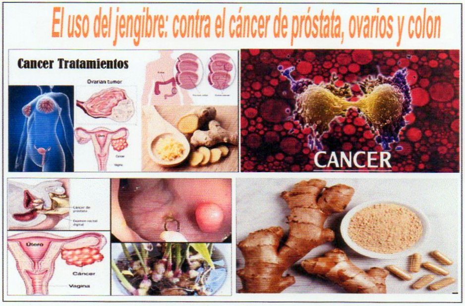 El uso del jengibre contra el c&aacute;ncer de pr&oacute;stata, ovarios y colon