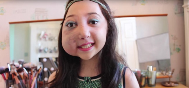 En sus 6 a&ntilde;os, se le diagnostic&oacute; un raro trastorno. Una historia conmovedora   