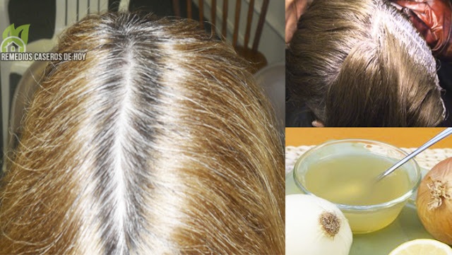 Eficaz remedio para eliminar las canas en s&oacute;lo 10 d&iacute;as