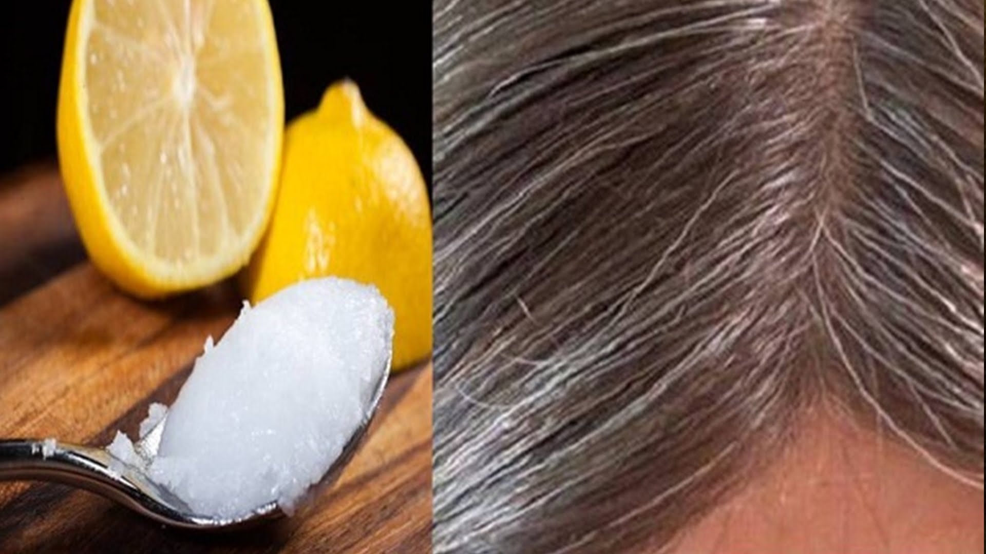 Combate las canas, la ca&iacute;da del cabello y la caspa con remedio natural