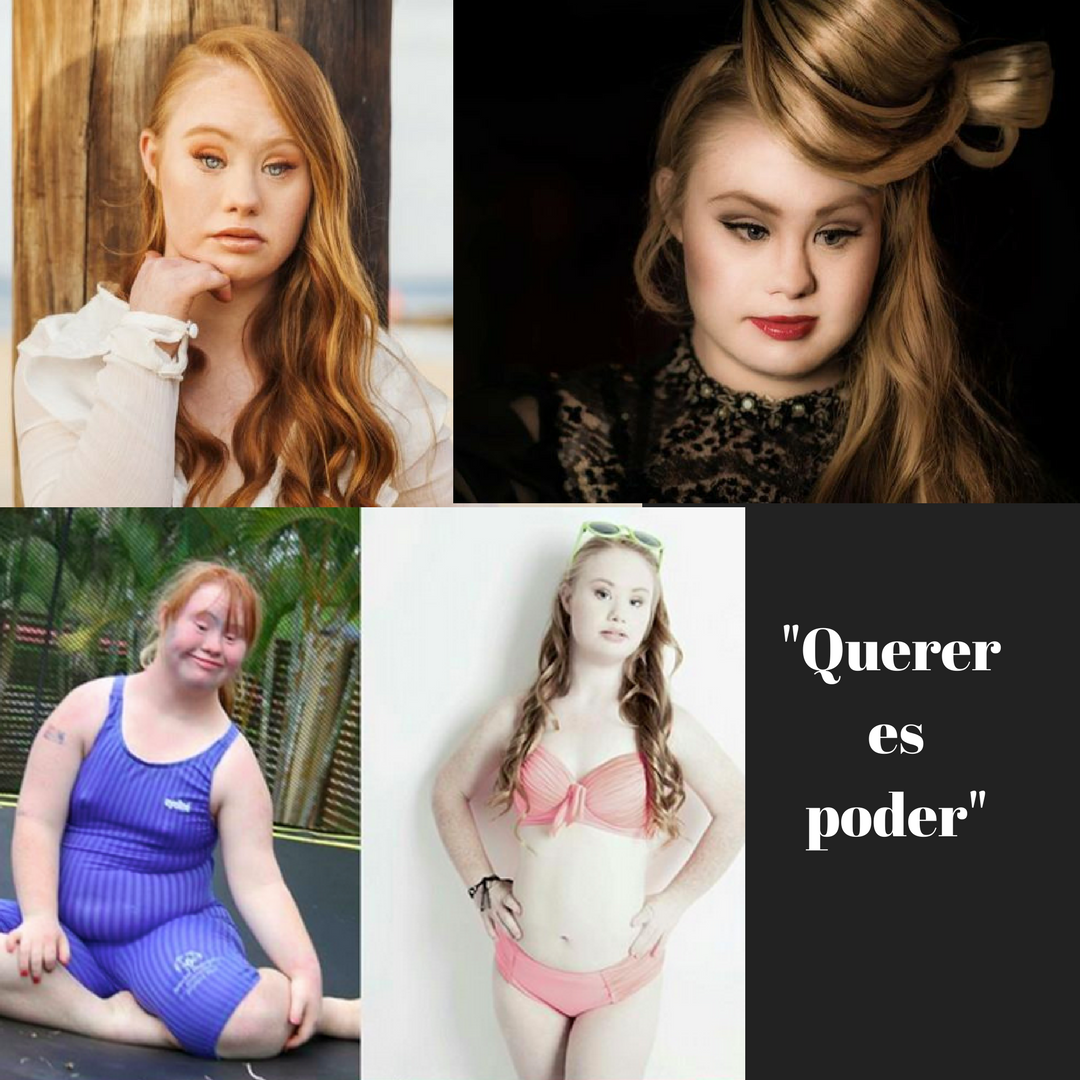 As&iacute; de hermosa se ve la primera modelo con S&iacute;ndrome de Down despu&eacute;s de haber perdido 25 kilos