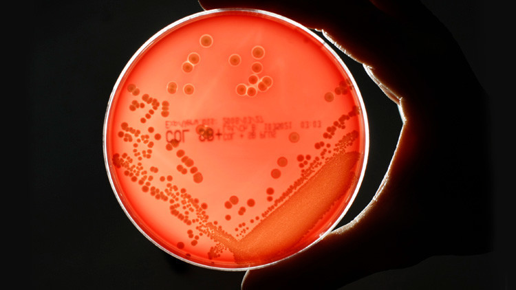 Una nueva 'superbacteria' resistente a los antibi&oacute;ticos alarma a la comunidad cient&iacute;fica: