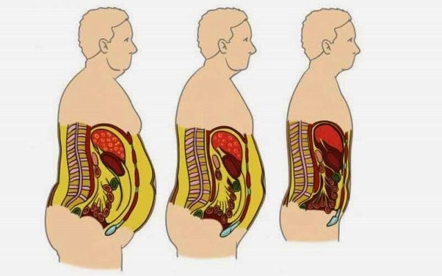 C&oacute;mo eliminar el colesterol de los vasos sangu&iacute;neos y perder peso