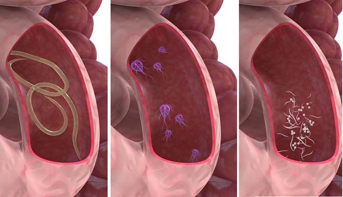  C&oacute;mo prevenir y eliminar par&aacute;sitos intestinales en nuestro organismo