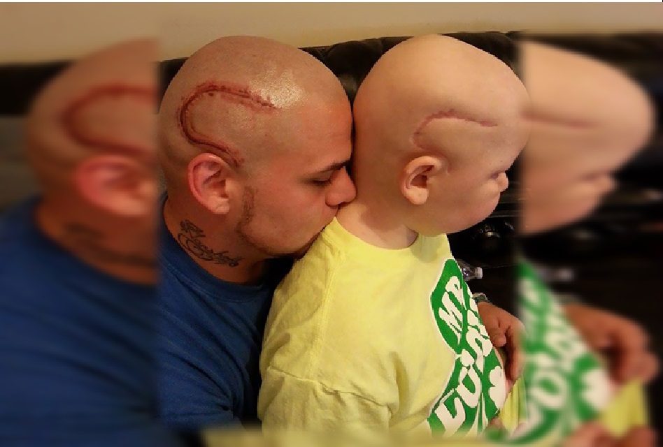 Un padre se tatu&oacute; una cicatriz igual a la de su hijo con c&aacute;ncer