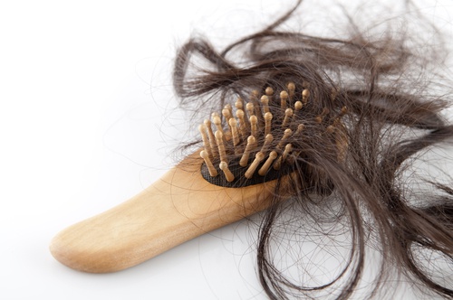 4 remedios naturales para la ca&iacute;da del cabello