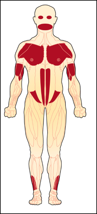 &iquest;Qu&eacute; es la Terapia G&eacute;nica para combatir la FSHD?