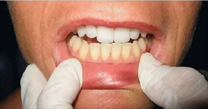 Por esta raz&oacute;n deber&iacute;as cepillarte los dientes con &eacute;stos dos poderosos ingredientes 