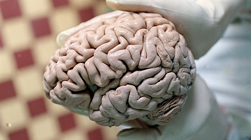 Identifican mol&eacute;culas que convierten el sonido en se&ntilde;ales al cerebro