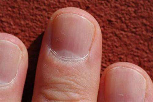 &iquest;Sab&iacute;as que el estado de tus u&ntilde;as puede decir mucho sobre tu salud?