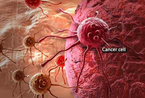 Alimentos que inhiben el crecimiento de las c&eacute;lulas del c&aacute;ncer