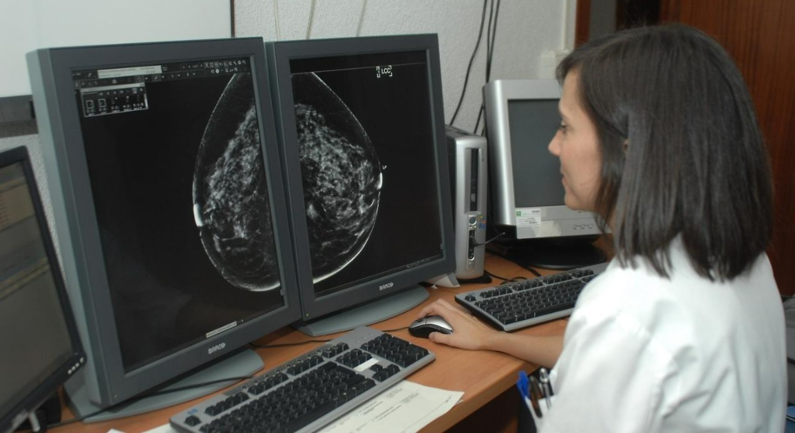 As&iacute; detecta la inteligencia artificial un c&aacute;ncer de mama con mucha antelaci&oacute;n: "Cinco a&ntilde;os antes"
