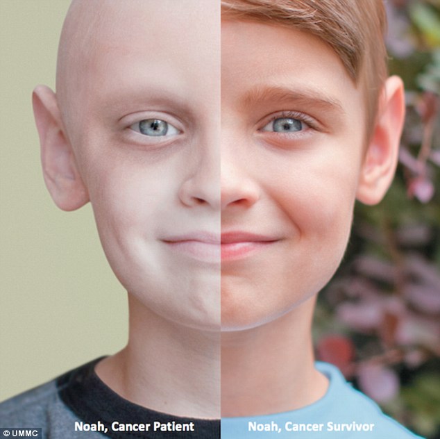  A hope for the cure of Leukemia: vaccine made with patients own cells 