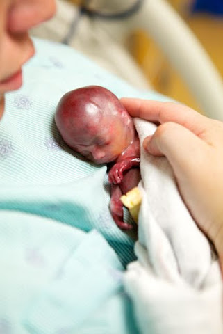 El beb&eacute; que est&aacute; cambiando el debate sobre el aborto