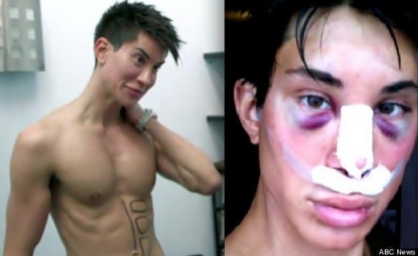 El Ken Humano