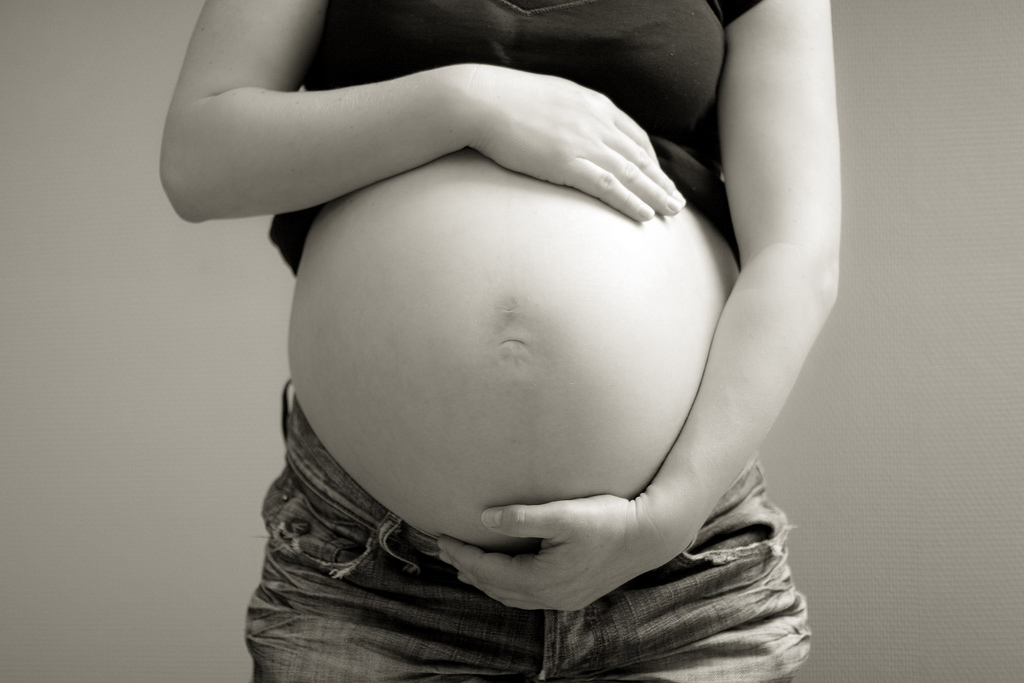  OPCI&Oacute;N PARA EL POSTPARTO: ABDOMINOPLAST&Iacute;A