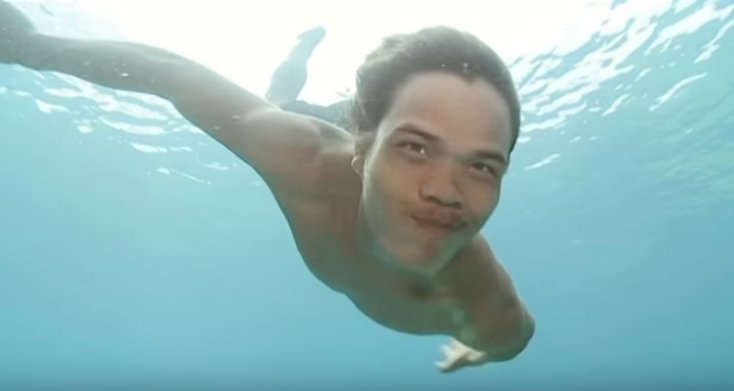 La asombrosa historia de los ni&ntilde;os con ojos de delf&iacute;n
