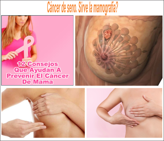C&aacute;ncer de seno. &iquest;Sirven las mamograf&iacute;as?