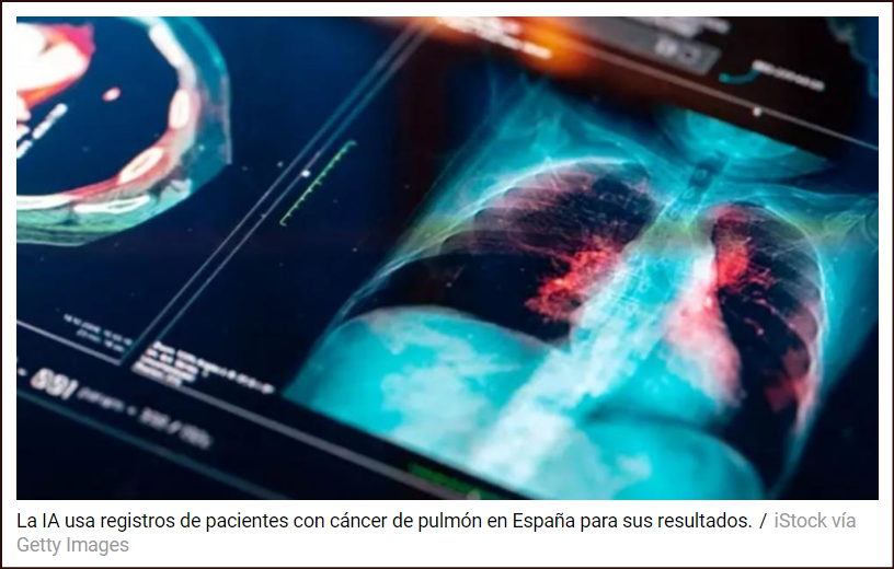 Una nueva terapia aumenta un 20% la supervivencia en pacientes con c&aacute;ncer de pulm&oacute;n intermedio