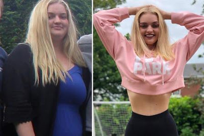 Padec&iacute;a de sobrepeso,pero cansada del Bullying decidi&oacute; bajar 62 kilos