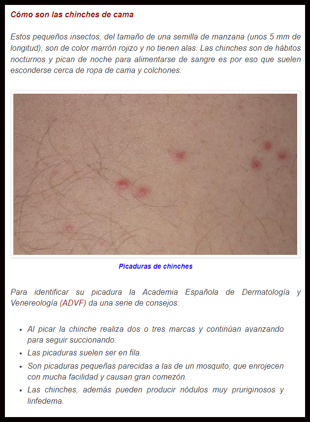  C&oacute;mo saber si te ha picado un chinche