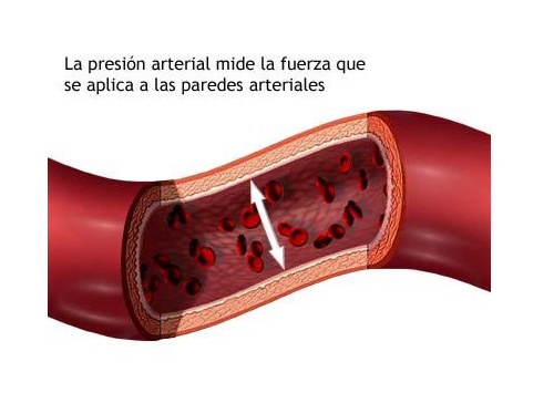 Todo lo que hay que saber sobre la presi&oacute;n arterial alta